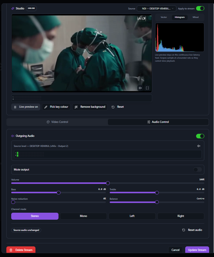 Professional Audio Adjustment in KLIPKAST Broadcaster MAX — Shape outgoing program audio directly in KLIPKAST Live Studio with source-level monitoring, mute and volume control, bass and treble adjustment, noise reduction, balance, stereo or